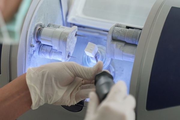 Why CEREC Crowns Are The Future Of Dental Restorations