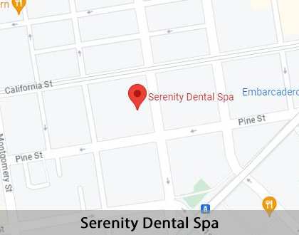 Map image for Dental Implants in San Francisco, CA