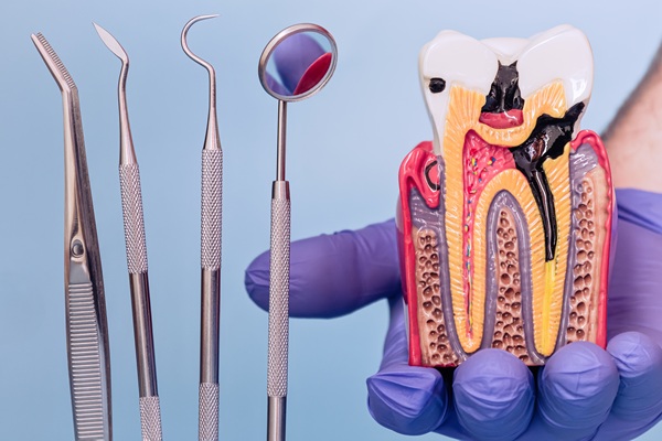 Endodontics    : What Really Happens During A Root Canal