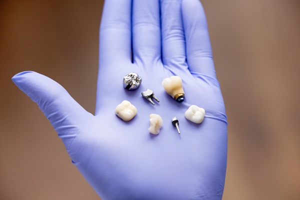 Learning Which Tooth Replacement Option To Choose: Implants, Bridges, Or Dentures?